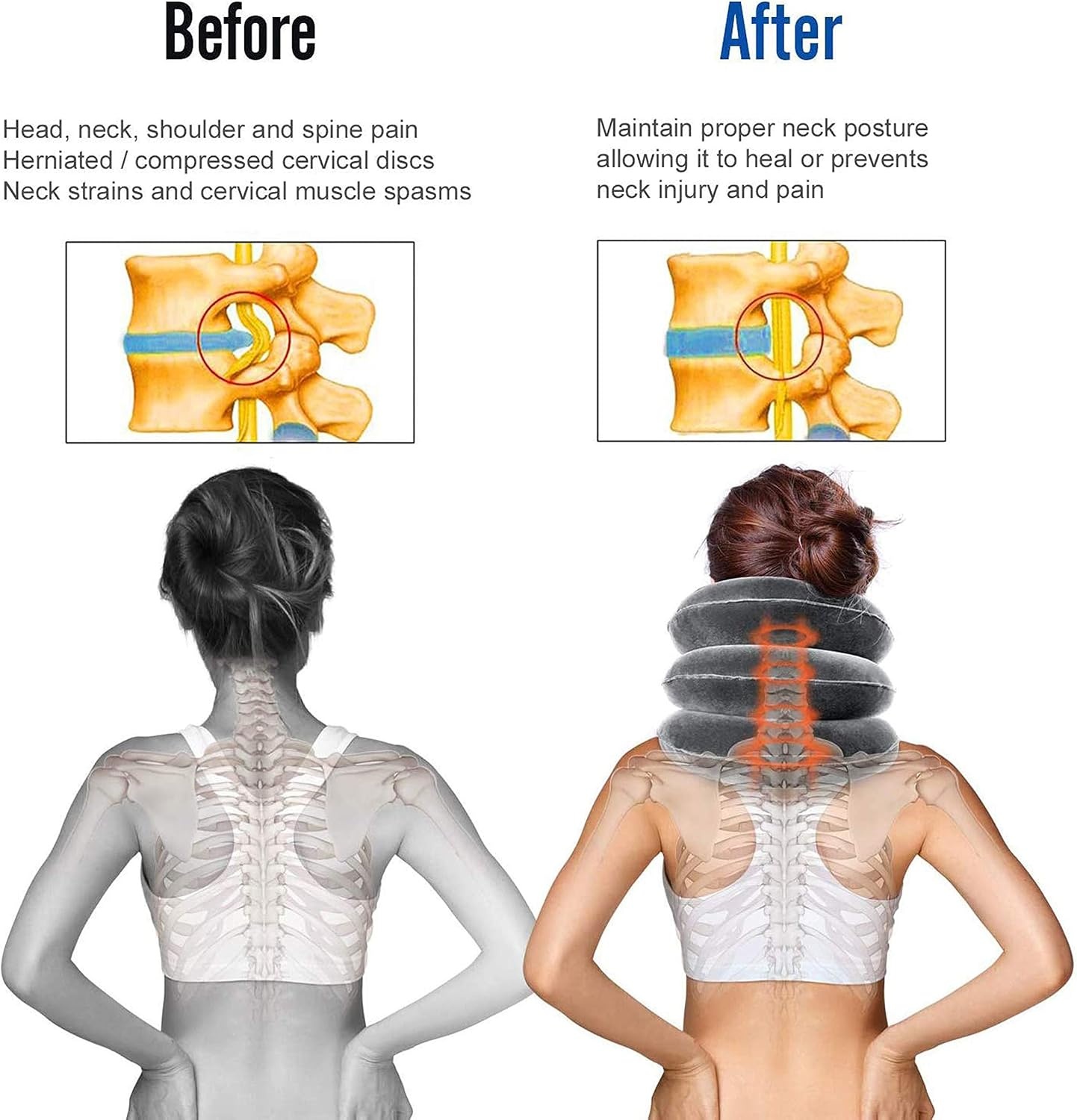 image:imageOhuhu Neck Cervical Traction Collar Device For Head ampNeck Pain Neck Spine Alignment Pillow Brown