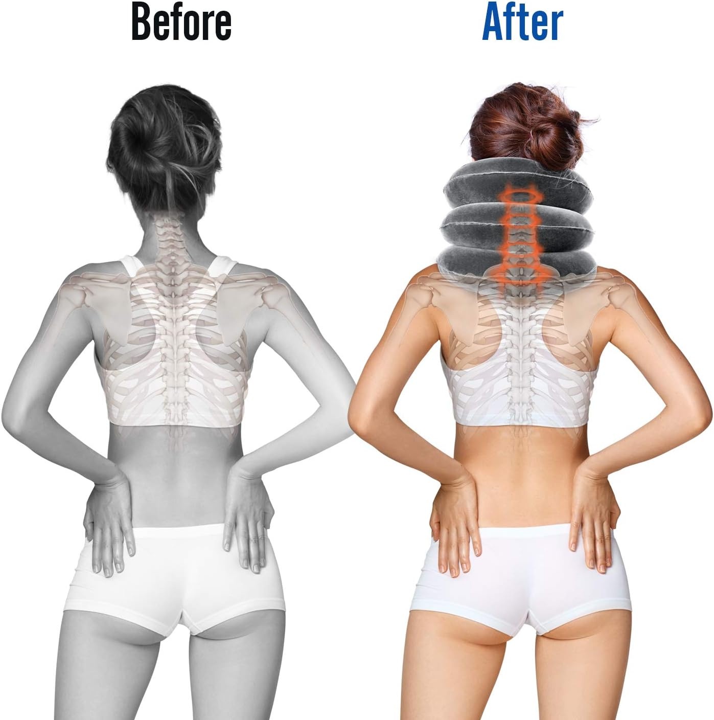 image:imageOhuhu Neck Cervical Traction Collar Device for Neck and Back Grey Grey
